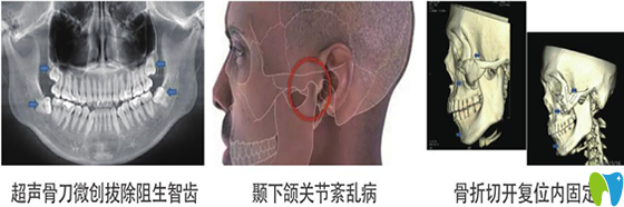 武汉存济口腔口腔颌面科可以治疗的项目