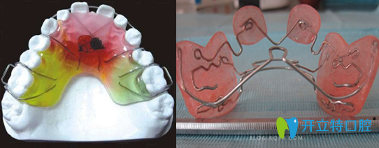小孩牙齿矫正怎么做？有没有孩子牙齿矫正的价格表呢？