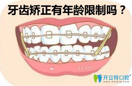 李解析牙齿矫正有年龄限制吗