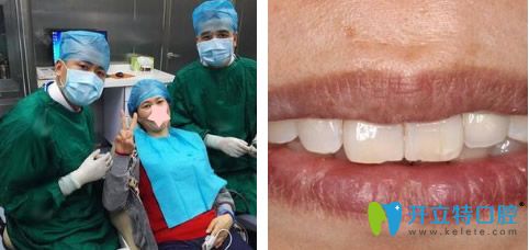 福州维乐口腔种植牙手术结束后牙齿修复图片