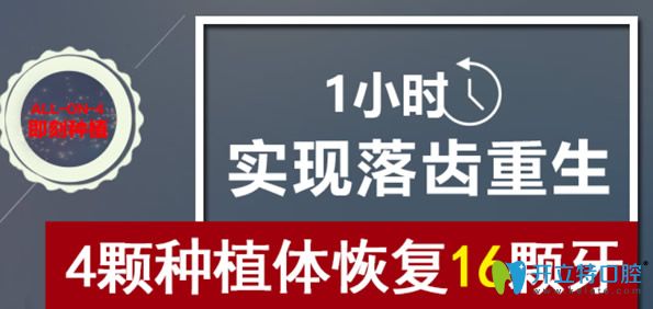 All-on-4即刻种植牙优势