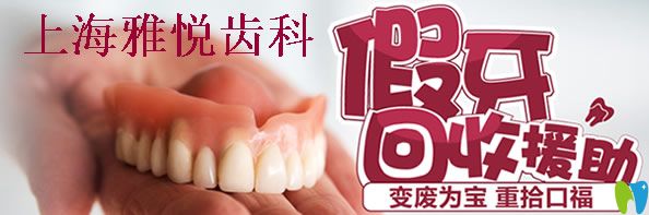 上海雅悦齿科优惠活动
