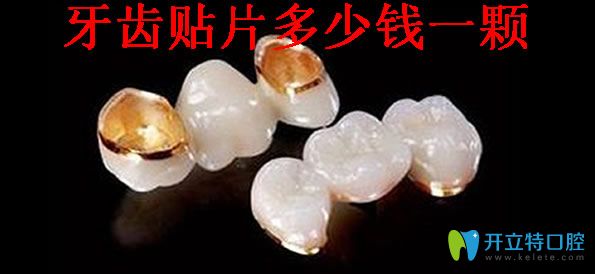 牙齿贴面多少钱一颗 牙齿贴面多少钱一颗