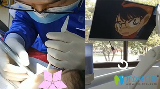 去昆明瑾帆口腔给孩子补牙 去昆明瑾帆口腔给孩子补牙