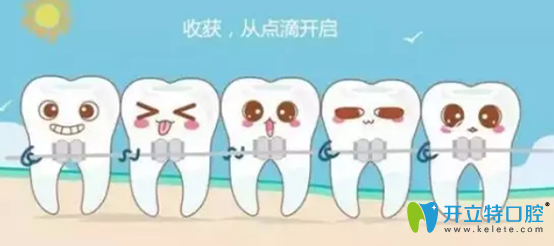 牙齿矫正好后保持器要戴多久