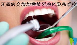 杭州植得口腔门诊解析牙周病会增加种植牙的风险和难度