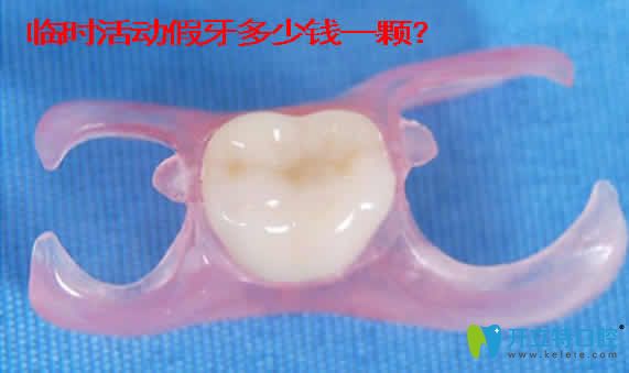 临时活动假牙能戴多久 资深牙医分享戴临时假牙注意事项 牙科治疗 开立特口腔