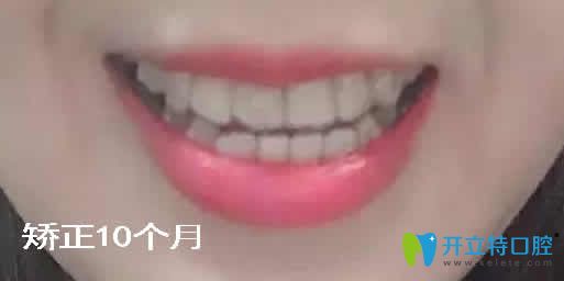20181206100894.jpg 2.jpg