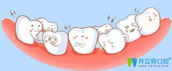 拉斐尔口腔医生告知牙齿缺失的危害