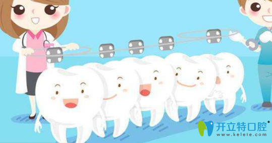 牙齿矫正是否可以只做单排/半口