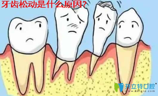 医生解析：牙齿松动是什么原因及牙齿松动了能自己恢复吗