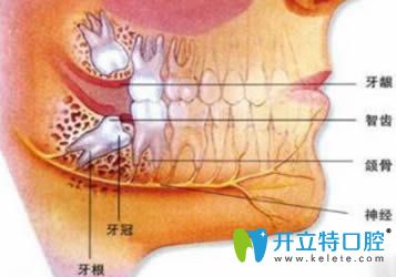 解答:急性智齿冠周炎并发症有哪些?如何治疗可以快速好转?