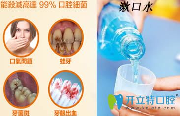 漱口水的作用说明图