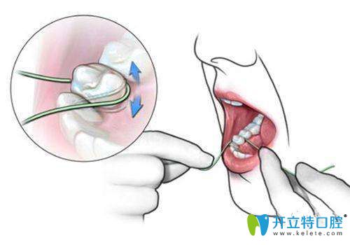 要学会使用牙线，保持口腔清洁