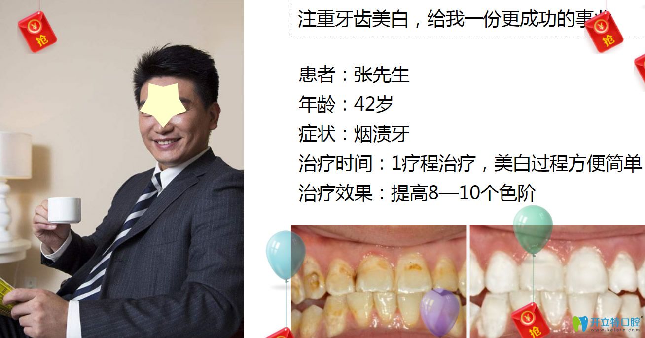 深圳牙齿美白哪里做?格伦菲尔口腔皓齿美白案例公布 深圳牙齿美白哪里做?格伦菲尔口腔皓齿美白案例公布