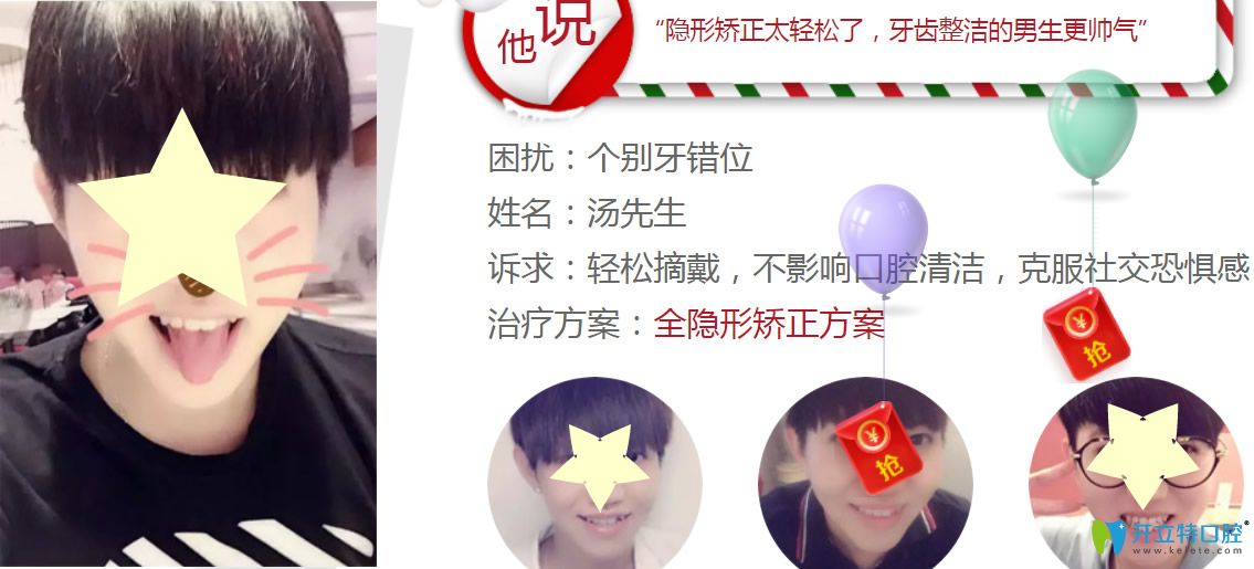 深圳格伦菲尔口腔水平怎么样?看牙齿正畸真人案例反馈 深圳格伦菲尔口腔水平怎么样?看牙齿正畸真人案例反馈