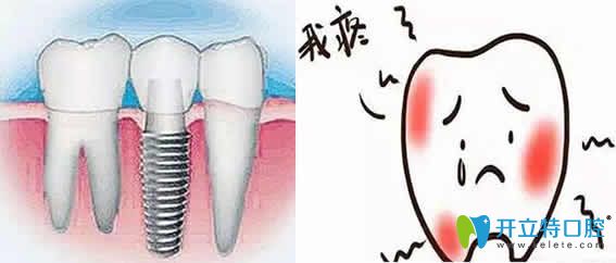 先了解种植牙后牙龈肿痛的原因，再看治疗方法