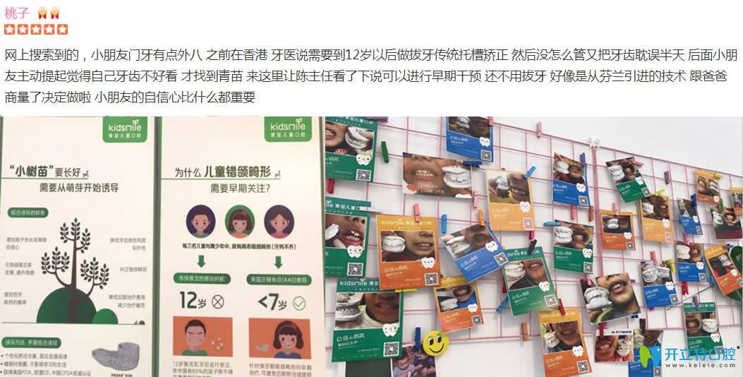 <!--<i data=20240703-sp></i>-->儿童口腔好不好？呈上近期顾客看牙评价