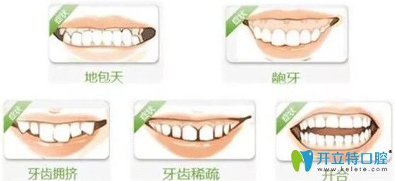 造成牙齿咬合问题的原因 造成牙齿咬合问题的原因