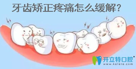 牙齿矫正疼痛怎么缓解 牙齿矫正疼痛怎么缓解