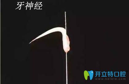 牙齿神经图片 牙齿神经图片