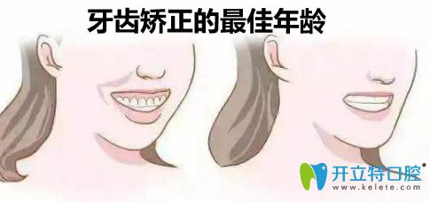 牙齿矫正的年龄