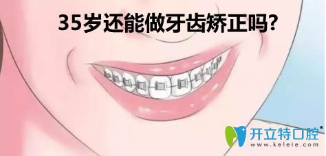 35岁还能牙齿矫正吗?正畸医生告诉你哪5类人不能做牙齿整形