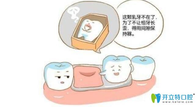 儿童牙齿间隙保持器总是必要的吗 儿童牙齿间隙保持器总是必要的吗