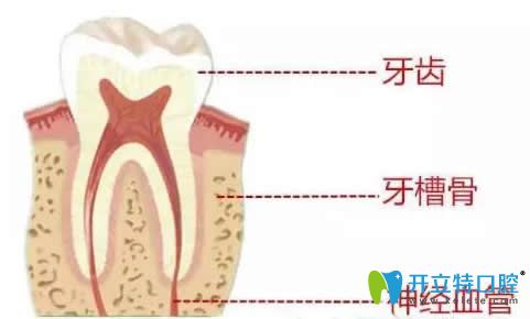 牙齿矫正对牙神经有没有伤害