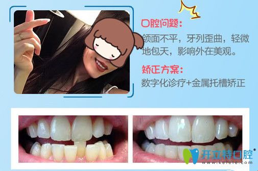 上海仁爱口腔牙齿矫正效果图