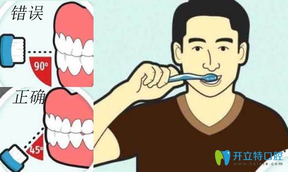 正确刷牙方法是呈45°能较大程度贴合牙龈