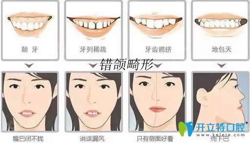 了解牙颌畸形的危害后你更想知道错颌畸形的矫治方法