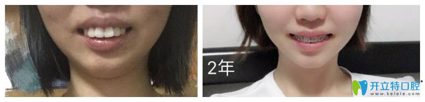 20190312397102.jpg