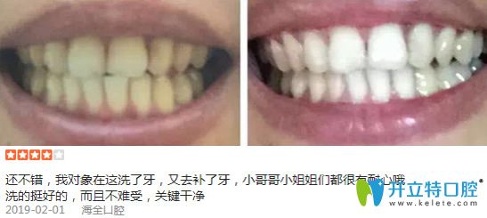 淄博海全口腔洁牙案例效果图