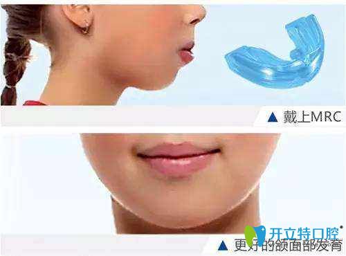 清远中大口腔阮林财医生介绍儿童牙齿畸形的原因 清远中大口腔阮林财医生介绍儿童牙齿畸形的原因