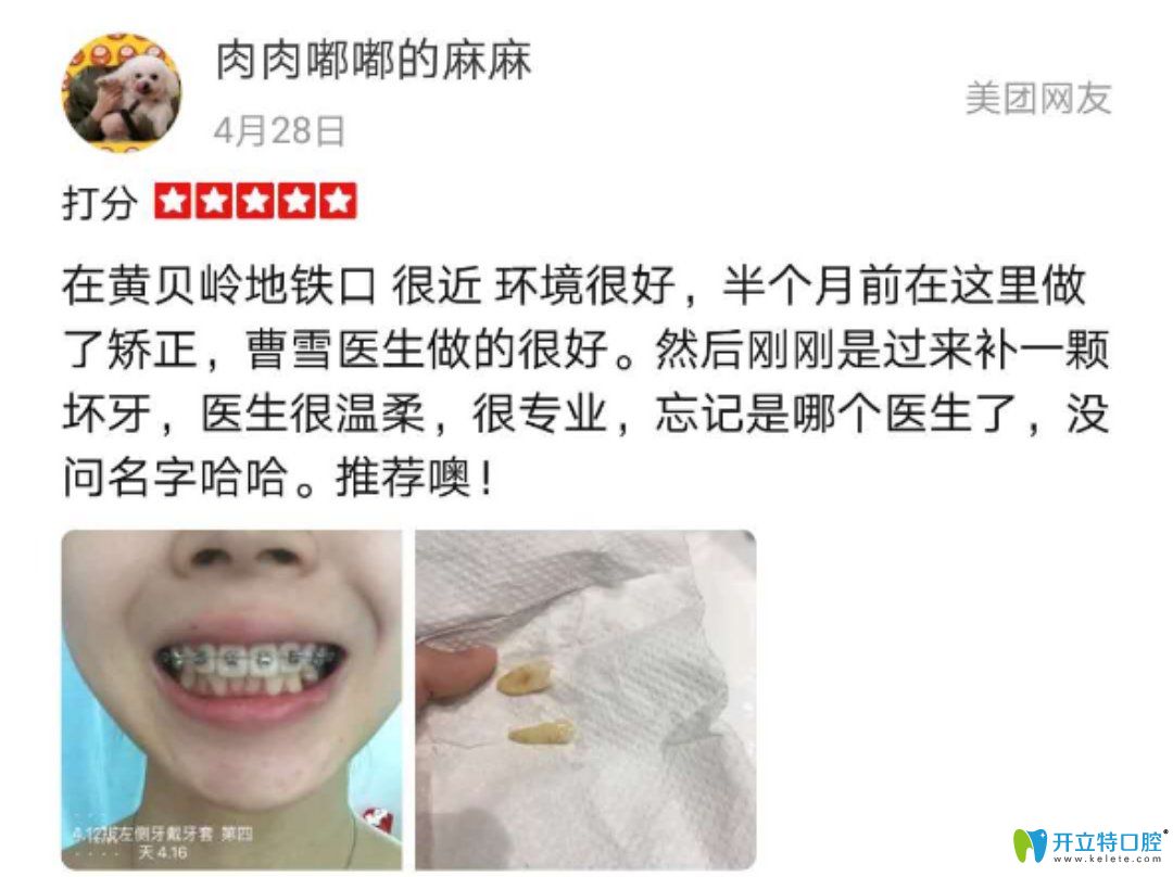 诺德齿科正畸真实反馈