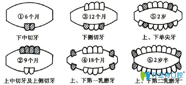 侧切牙缺失怎么办，有什么影响？