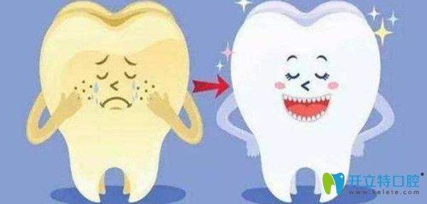 牙齿美白的过程