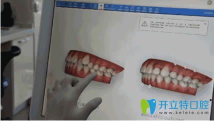 茅来发医生讲解牙齿正畸中的影像分析