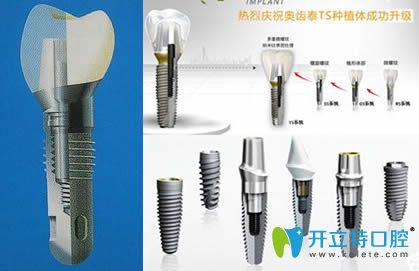 韩国奥齿泰种植牙种植体