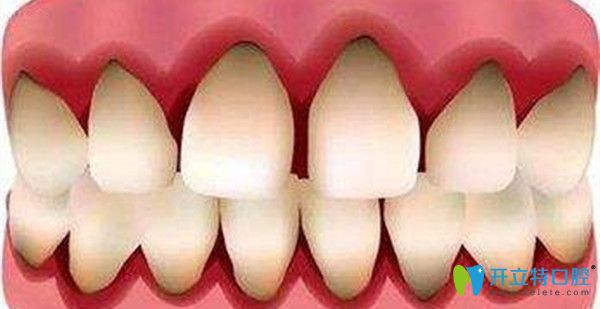 导致牙龈萎缩的原因有哪些