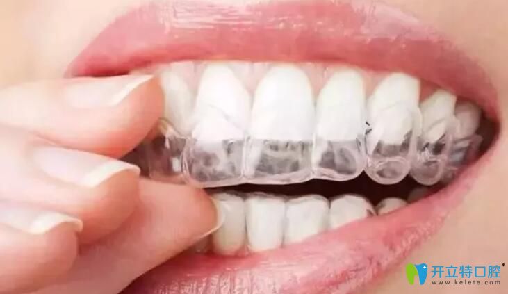 正畸咬胶使隐形牙套更贴合,更隐形 正畸咬胶使隐形牙套更贴合,更隐形