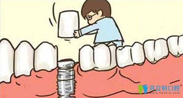 微创种植牙与普通种植牙的区别