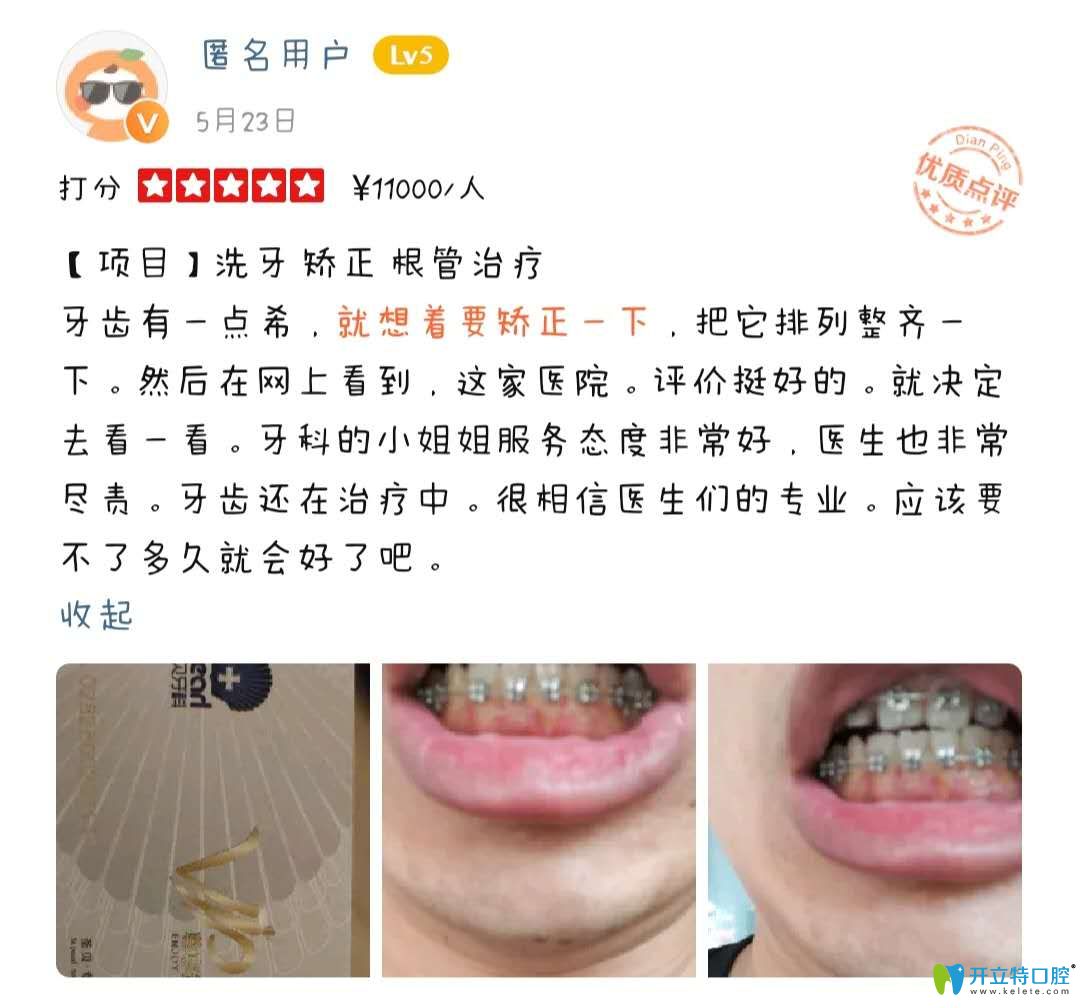 网友评价在网上看到圣贝矫正好评后决定到圣贝做正畸