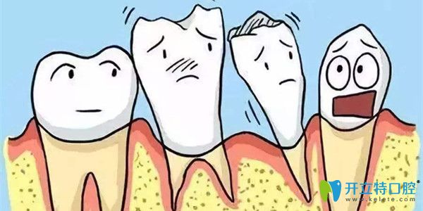 牙周病是导致牙齿掉的根本原因