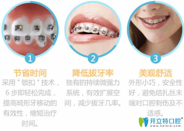 选择青岛诺德齿科黄主任做牙齿矫正的技术优势