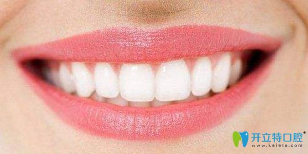 牙齿清洁到位才能避免产生口腔问题