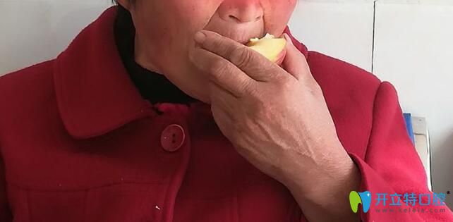 刚装上吸附性全口义齿就当场吃起苹果