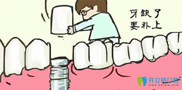 当牙齿缺失时,要及时补上 当牙齿缺失时,要及时补上