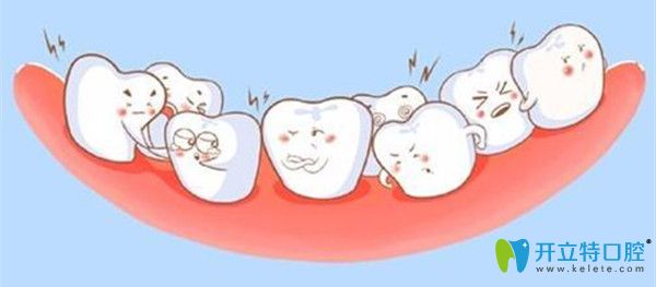 牙齿整齐更重要的是咬合关系